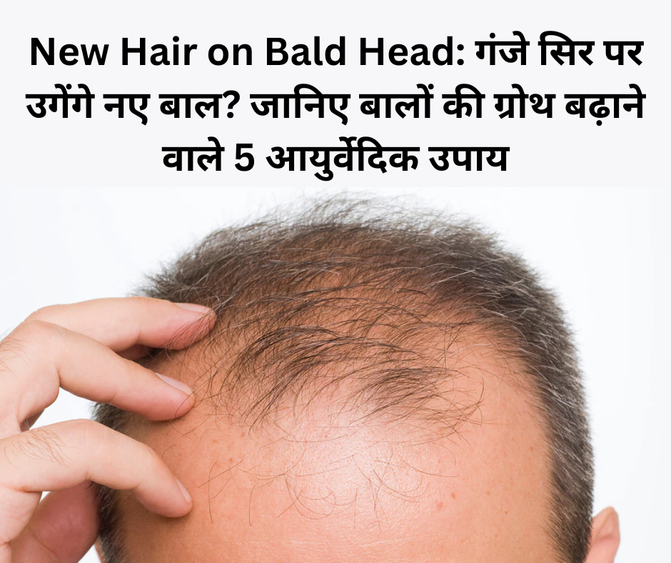 New Hair on Bald Head